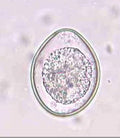 Fecal Egg Count